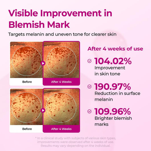The Calcium Lift Ritual | 3-Step Firm · Brighten · Glow Routine