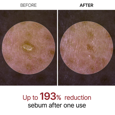 Black Rice Glow Ampoule | Pore-Refining Treatment